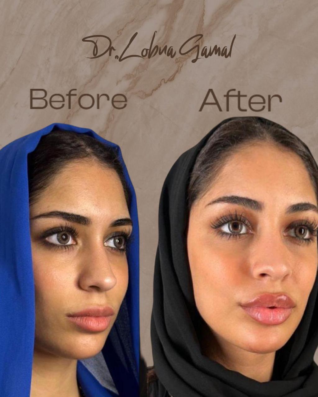 Treatment Result
